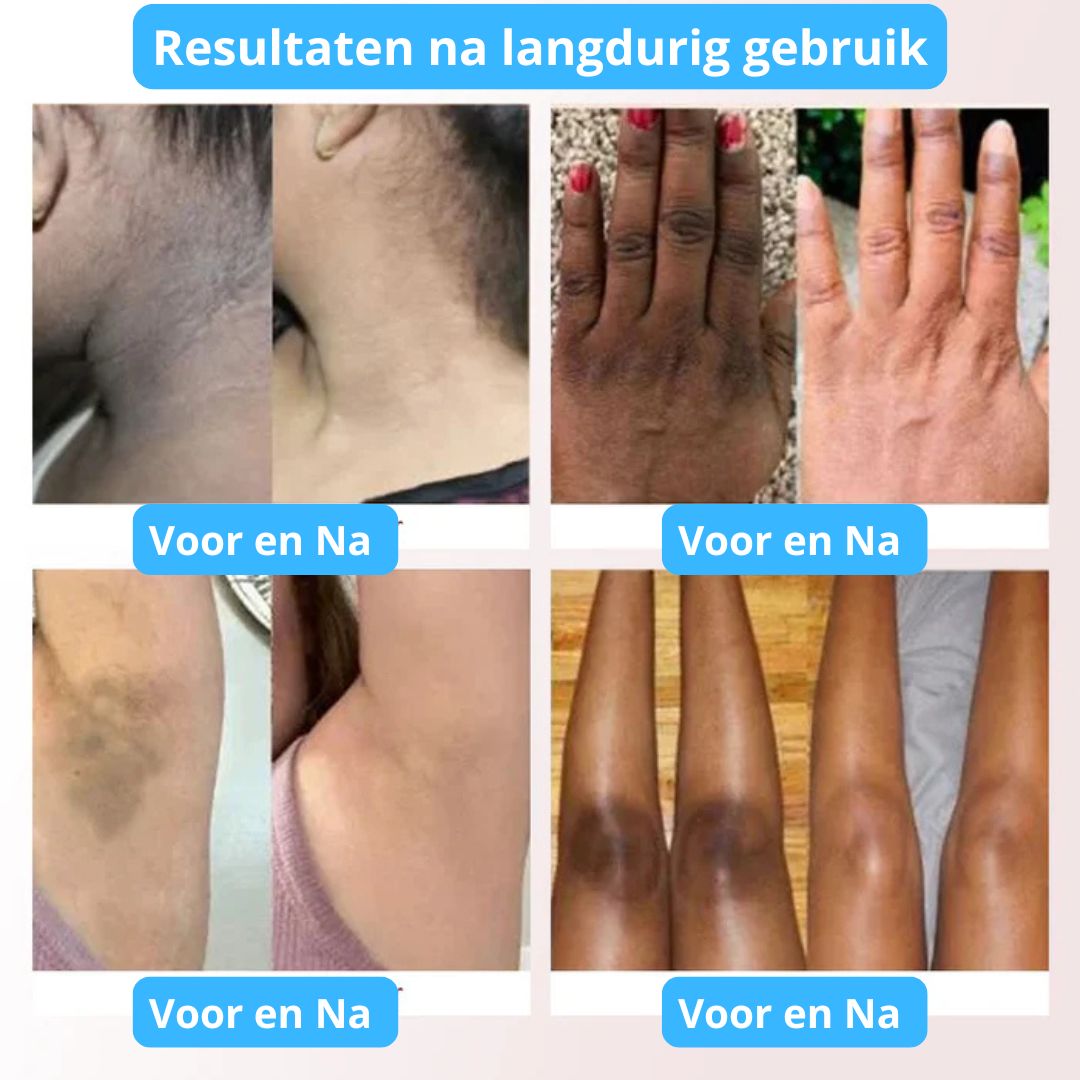 PHANSTA - Kropps- och ansiktsskrubbgel – Djup rengöring och återfuktning 50 ml